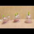 Acupuncture Perth For Natural Pain Relief And Holistic Care