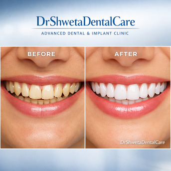 New Delhi, Health, Dentist & Advanced Dental Clinic