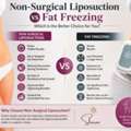 Non-Surgical Liposuction Vs Fat Freezing: Best Choice Guide