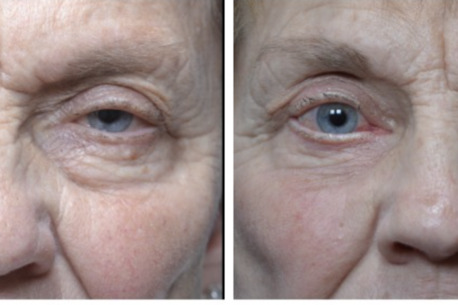 New York, Health, Enhance Your Beauty With Expert Cosmetic Surgery In Utah