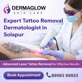 Mumbai, Medical, Leading Tattoo Removal Clinic In Solapur | Modern Skin Treatments