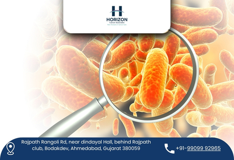 Ahmedabad, Health, Experienced Surgical Oncologist In Ahmedabad For Cancer Care