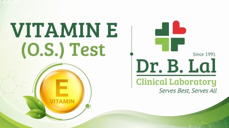 Jaipur, Health & Beauty Items, INR 4520,  Diagnostic Vitamin E Test | For Unexplained Muscle Weakness
