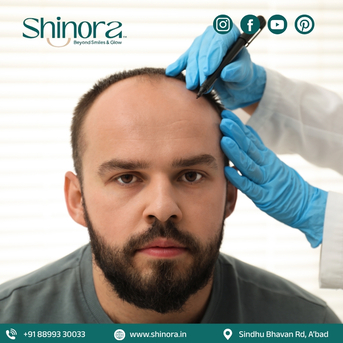 Ahmedabad, Health, Shinora Clinic - Advanced Technology For Hair Transplant In Ahmedabad