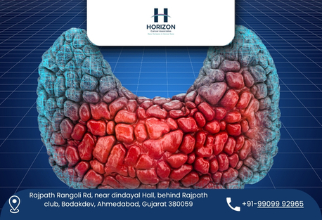 Ahmedabad, Health, Experienced Hernia Surgeon In Ahmedabad For Fast Recovery