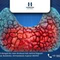Experienced Hernia Surgeon In Ahmedabad For Fast Recovery