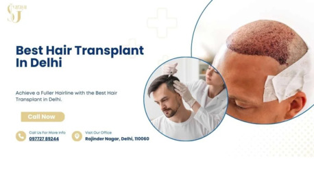New Delhi, Business, Best Hair Transplant Surgeon In Delhi For Safe And Natural Results