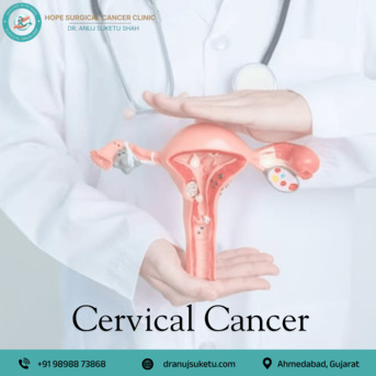 Ahmedabad, Health, Consult Dr. Anuj Suketu Shah For Cervical Cancer Treatment In Ahmedabad