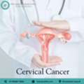 Consult Dr. Anuj Suketu Shah For Cervical Cancer Treatment In Ahmedabad