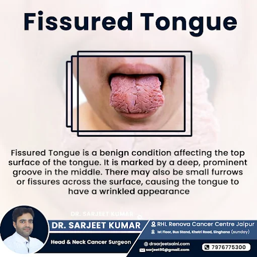 Jaipur, Health, Dr. Sarjeet Kumar Saini Head & Neck Cancer Surgeon Jaipur