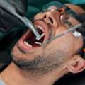 Safe & Gentle Tooth Extraction In Beverly Hills