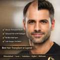 Ahmedabad Hair Transplant Near Me