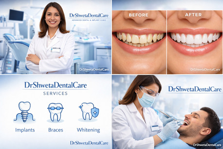 New Delhi, Health, Zoom Teeth Whitening Price In Delhi India