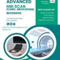 MRI Scan Beveridge