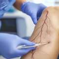Expert Vascular Surgeon In Gandhinagar