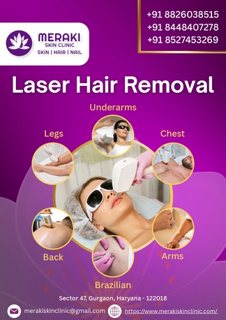 Gurgaon, Health, How Laser Hair Removal In Gurgaon Helps You Achieve Smooth & Hair-Free Skin