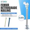 Reliable Fixation With Advanced Femur Retrograde Nailing
