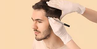 New Delhi, Health, You Can STOP Hair Loss | 50,000+ Trusted Us For Their Hair Concern