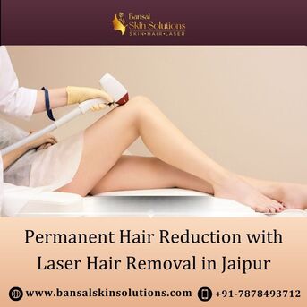Jaipur, Health, Permanent Hair Reduction With Laser Hair Removal In Jaipur