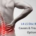 Advanced Disc Bulge Treatment In India &ndash; Effective Spine Care & Pain Relief Solutions