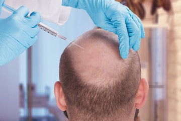 Manchester, Beautician, Want Hair Ltd - Trusted FUE Hair Transplant Clinic In Manchester