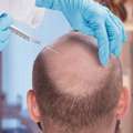 Want Hair Ltd - Trusted FUE Hair Transplant Clinic In Manchester