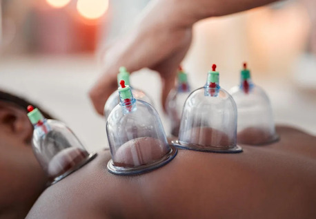 London, Health, Flower Of Life: Cuppinge Therapy Healing