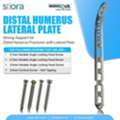 Strong Support For Distal Humerus Fractures With Lateral Plate