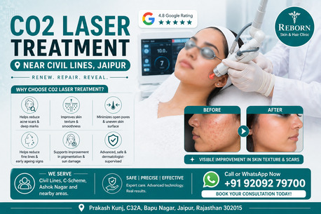 Jaipur, Health & Beauty Items, INR 4000,  Get Smooth Skin CO2 Laser Treatment Near Civil Lines, Jaipur