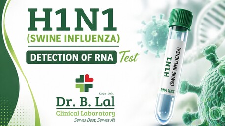 Jaipur, Health & Beauty Items, INR 4500,  Complete Swine Flu Diagnosis Package | H1N1 RNA Test With Home Visit