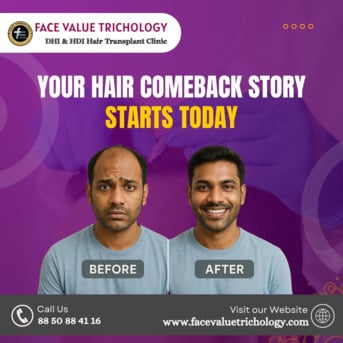 Chennai, Legal, Best Hair Transplant Clinic &ndash; Get Your Hair Comeback Today