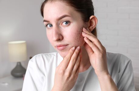 New York, Health, Gentle Daily Cleanse For Breakout-Prone Skin