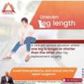 Robotic Hip Replacement Surgeon In Pune   - Dr. Aashish Arbat
