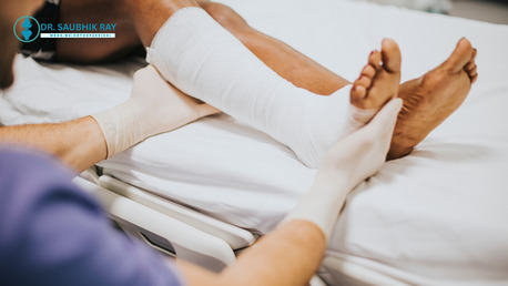 Kolkata, Health, Fracture Treatment In Kolkata: When To Act And What To Expect