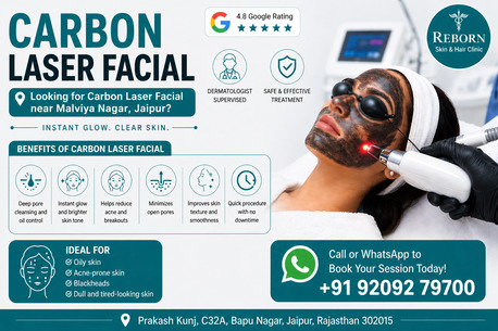 Jaipur, Health & Beauty Items, INR 3999,  Carbon Laser Facial Near Malviya Nagar, Jaipur - Consult Now