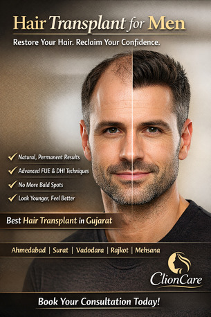 Ahmedabad, Health, Hair Transplant For Man In India