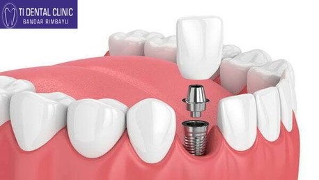 Kuala Lumpur, Businesses For Sale, Pediatric Dentistry: Preventive Care, Digital Technology