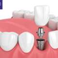 Pediatric Dentistry: Preventive Care, Digital Technology