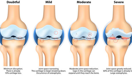 Mumbai, Business, Best Knee Specialist In Mumbai | Advanced Knee Care & Treatment