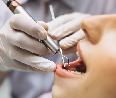 Mumbai, Dental, Stop Avoiding Photos, Get A Celebrity Smile Makeover Today! - Smile Sculptors