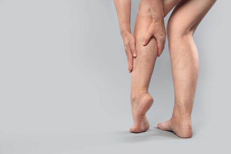 Sydney, Health, Get Rid Of Facial Veins Fast &ndash; Proven Capillary Treatment
