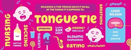 Toronto, Dental, Looking For Laser Tongue & Lip Tie Treatment For Kids? | SmileSquad