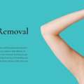 Best Laser Hair Removal In Noida For Smooth, Hair-Free Skin