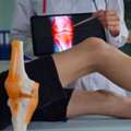 Patellofemoral Instability Treatment In Manchester | Knee Specialist