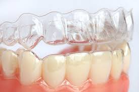 Toronto, Dental, Invisalign Etobicoke - Book Your Free Consultation Today