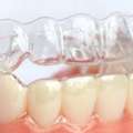 Invisalign Etobicoke - Book Your Free Consultation Today