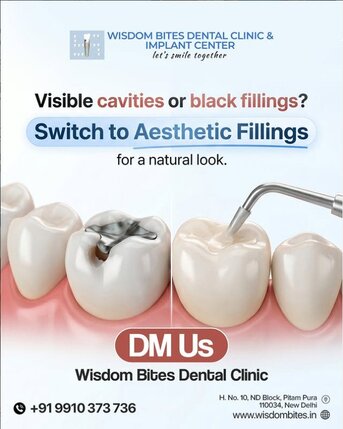 New Delhi, Health, Visit The Best Dental Hospital In Delhi Today