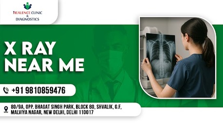 New Delhi, Health, X Ray Near Me | Fast & Affordable Digital X-Ray Services In Delhi
