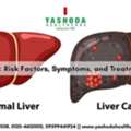 Best Hospital For Liver Cancer