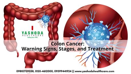 Ghaziabad, Health, Best Hospital For Colon Cancer